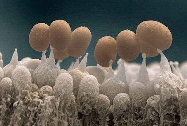 mikroskop altında ayak tırnağı mantarı