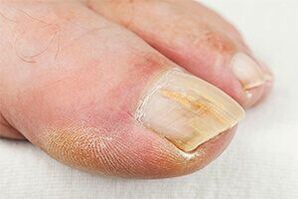 Zemin -Finger
