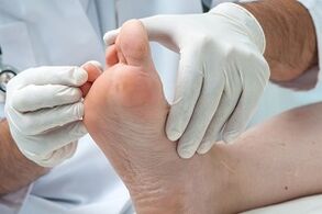doktor ayak parmaklarında mantar olup olmadığını inceliyor