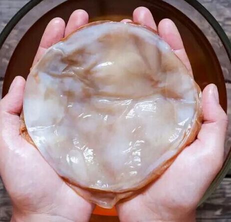 tırnak mantarı kombucha