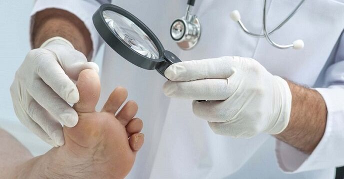 Doktor ayakları tırnak mantarı açısından inceler